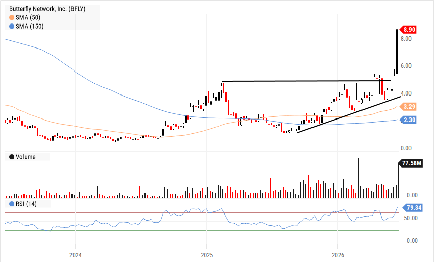 BFLY — Butterfly Network chart of the week showing uptrend with breakout above $6 resistance level